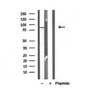 DF12128 staining HepG2 by IF/ICC. The sample were fixed with PFA and permeabilized in 0.1% Triton X-100,then blocked in 10% serum for 45 minutes at 25¡ãC. The primary antibody was diluted at 1/200 and incubated with the sample for 1 hour at 37¡ãC. An  Alexa Fluor 594 conjugated goat anti-rabbit IgG (H+L) Ab, diluted at 1/600, was used as the secondary antibod