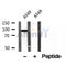 DF12129 at 1/100 staining Human gastric tissue by IHC-P. The sample was formaldehyde fixed and a heat mediated antigen retrieval step in citrate buffer was performed. The sample was then blocked and incubated with the antibody for 1.5 hours at 22¡ãC. An HRP conjugated goat anti-rabbit antibody was used as the secondary