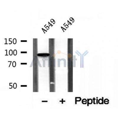 DF12129 at 1/100 staining Human gastric tissue by IHC-P. The sample was formaldehyde fixed and a heat mediated antigen retrieval step in citrate buffer was performed. The sample was then blocked and incubated with the antibody for 1.5 hours at 22¡ãC. An HRP conjugated goat anti-rabbit antibody was used as the secondary
