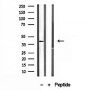 Western blot analysis of extracts from rat brain, using PSAT1 antibody. Lane 1 was treated with the blocking peptide.