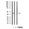 Western blot analysis of extracts from rat brain, using PSAT1 antibody. Lane 1 was treated with the blocking peptide.