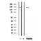 DF12133 staining HepG2 by IF/ICC. The sample were fixed with PFA and permeabilized in 0.1% Triton X-100,then blocked in 10% serum for 45 minutes at 25¡ãC. The primary antibody was diluted at 1/200 and incubated with the sample for 1 hour at 37¡ãC. An  Alexa Fluor 594 conjugated goat anti-rabbit IgG (H+L) Ab, diluted at 1/600, was used as the secondary antibod