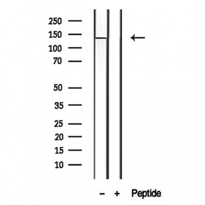 DF12133 staining HepG2 by IF/ICC. The sample were fixed with PFA and permeabilized in 0.1% Triton X-100,then blocked in 10% serum for 45 minutes at 25¡ãC. The primary antibody was diluted at 1/200 and incubated with the sample for 1 hour at 37¡ãC. An  Alexa Fluor 594 conjugated goat anti-rabbit IgG (H+L) Ab, diluted at 1/600, was used as the secondary antibod