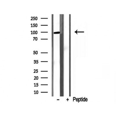 Western blot analysis of extracts from various samples, using PYGL antibody.
 Lane 1: Hela treated with blocking peptide.
 Lane 2: Hela;
 Lane 3: Mouse Myeloma cell;
 Lane 4: mouse lung;
 Lane 5: rat brain;
 