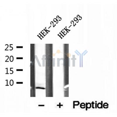 DF12136 at 1/100 staining Mouse kidney tissue by IHC-P. The sample was formaldehyde fixed and a heat mediated antigen retrieval step in citrate buffer was performed. The sample was then blocked and incubated with the antibody for 1.5 hours at 22¡ãC. An HRP conjugated goat anti-rabbit antibody was used as the secondary