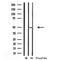 DF12139 staining HepG2 by IF/ICC. The sample were fixed with PFA and permeabilized in 0.1% Triton X-100,then blocked in 10% serum for 45 minutes at 25¡ãC. The primary antibody was diluted at 1/200 and incubated with the sample for 1 hour at 37¡ãC. An  Alexa Fluor 594 conjugated goat anti-rabbit IgG (H+L) Ab, diluted at 1/600, was used as the secondary antibod