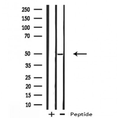 DF12139 staining HepG2 by IF/ICC. The sample were fixed with PFA and permeabilized in 0.1% Triton X-100,then blocked in 10% serum for 45 minutes at 25¡ãC. The primary antibody was diluted at 1/200 and incubated with the sample for 1 hour at 37¡ãC. An  Alexa Fluor 594 conjugated goat anti-rabbit IgG (H+L) Ab, diluted at 1/600, was used as the secondary antibod