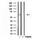 Western blot analysis of extracts from Mouse liver, using UGT2B7 Antibody. Lane 1 was treated with the blocking peptide.