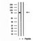 Western blot analysis of extracts from various samples, using ACSL4/FACL4 Antibody.
 Lane 1: 3t3 treated with blocking peptide;
 Lane 2: 3t3;
Lane 3: Mouse spleen.