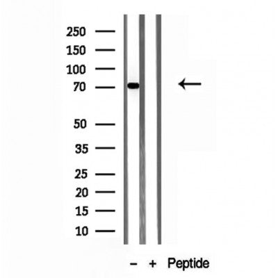 Western blot analysis of extracts from various samples, using ACSL4/FACL4 Antibody.
 Lane 1: 3t3 treated with blocking peptide;
 Lane 2: 3t3;
Lane 3: Mouse spleen.