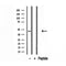 DF12142 staining HepG2 by IF/ICC. The sample were fixed with PFA and permeabilized in 0.1% Triton X-100,then blocked in 10% serum for 45 minutes at 25¡ãC. The primary antibody was diluted at 1/200 and incubated with the sample for 1 hour at 37¡ãC. An  Alexa Fluor 594 conjugated goat anti-rabbit IgG (H+L) Ab, diluted at 1/600, was used as the secondary antibod