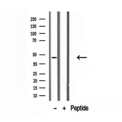 DF12142 staining HepG2 by IF/ICC. The sample were fixed with PFA and permeabilized in 0.1% Triton X-100,then blocked in 10% serum for 45 minutes at 25¡ãC. The primary antibody was diluted at 1/200 and incubated with the sample for 1 hour at 37¡ãC. An  Alexa Fluor 594 conjugated goat anti-rabbit IgG (H+L) Ab, diluted at 1/600, was used as the secondary antibod