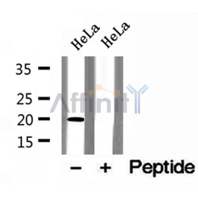 DF12143 at 1/100 staining Human liver tissue by IHC-P. The sample was formaldehyde fixed and a heat mediated antigen retrieval step in citrate buffer was performed. The sample was then blocked and incubated with the antibody for 1.5 hours at 22¡ãC. An HRP conjugated goat anti-rabbit antibody was used as the secondary