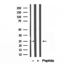 Western blot analysis of extracts from various samples, using ATP5F1 Antibody.
 Lane 1: Mouse spleen treated with blocking peptide;
 Lane 2: Mouse spleen;
Lane 3: HepG2.