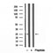 Western blot analysis of extracts from various samples, using ATP5F1 Antibody.
 Lane 1: Mouse spleen treated with blocking peptide;
 Lane 2: Mouse spleen;
Lane 3: HepG2.
