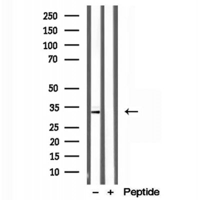 Western blot analysis of extracts from Mouse brain, using CAPZA1 Antibody. The lane on the left was treated with blocking peptide.