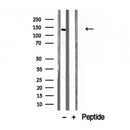 Western blot analysis of extracts from mouse brain, using CCP1 antibody. Lane 1 was treated with the blocking peptide.