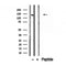 Western blot analysis of extracts from mouse brain, using CCP1 antibody. Lane 1 was treated with the blocking peptide.
