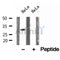 DF12147 at 1/100 staining Mouse kidney tissue by IHC-P. The sample was formaldehyde fixed and a heat mediated antigen retrieval step in citrate buffer was performed. The sample was then blocked and incubated with the antibody for 1.5 hours at 22¡ãC. An HRP conjugated goat anti-rabbit antibody was used as the secondary