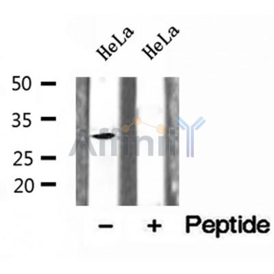 DF12147 at 1/100 staining Mouse kidney tissue by IHC-P. The sample was formaldehyde fixed and a heat mediated antigen retrieval step in citrate buffer was performed. The sample was then blocked and incubated with the antibody for 1.5 hours at 22¡ãC. An HRP conjugated goat anti-rabbit antibody was used as the secondary