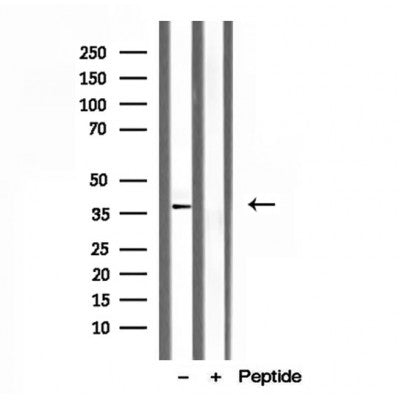 Western blot analysis of extracts from VERO, using CLTA Antibody. The lane on the left was treated with blocking peptide.