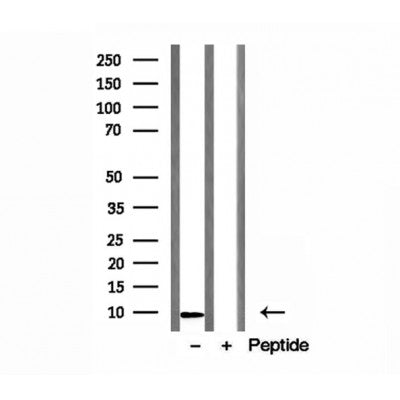 DF12152 at 1/100 staining Rat lung tissue by IHC-P. The sample was formaldehyde fixed and a heat mediated antigen retrieval step in citrate buffer was performed. The sample was then blocked and incubated with the antibody for 1.5 hours at 22¡ãC. An HRP conjugated goat anti-rabbit antibody was used as the secondary