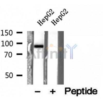 DF12153 at 1/100 staining Mouse lung tissue by IHC-P. The sample was formaldehyde fixed and a heat mediated antigen retrieval step in citrate buffer was performed. The sample was then blocked and incubated with the antibody for 1.5 hours at 22¡ãC. An HRP conjugated goat anti-rabbit antibody was used as the secondary