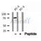 DF12154 at 1/100 staining Human breast cancer tissue by IHC-P. The sample was formaldehyde fixed and a heat mediated antigen retrieval step in citrate buffer was performed. The sample was then blocked and incubated with the antibody for 1.5 hours at 22¡ãC. An HRP conjugated goat anti-rabbit antibody was used as the secondary