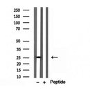 DF12157 staining HepG2 by IF/ICC. The sample were fixed with PFA and permeabilized in 0.1% Triton X-100,then blocked in 10% serum for 45 minutes at 25¡ãC. The primary antibody was diluted at 1/200 and incubated with the sample for 1 hour at 37¡ãC. An  Alexa Fluor 594 conjugated goat anti-rabbit IgG (H+L) Ab, diluted at 1/600, was used as the secondary antibod
