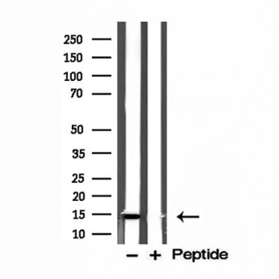 DF12158 staining HepG2 by IF/ICC. The sample were fixed with PFA and permeabilized in 0.1% Triton X-100,then blocked in 10% serum for 45 minutes at 25¡ãC. The primary antibody was diluted at 1/200 and incubated with the sample for 1 hour at 37¡ãC. An  Alexa Fluor 594 conjugated goat anti-rabbit IgG (H+L) Ab, diluted at 1/600, was used as the secondary antibod