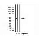 Western blot analysis of extracts from Hela, using L2HGDH Antibody. Lane 1 was treated with the blocking peptide.