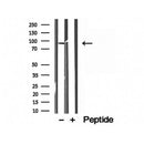Western blot analysis of extracts from various samples, using LMOD1 antibody.
 Lane 1: Mouse Myeloma cell treated with blocking peptide.
 Lane 2: Mouse Myeloma cell;
 Lane 3: HepG2;
 