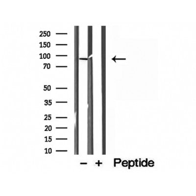 Western blot analysis of extracts from various samples, using LMOD1 antibody.
 Lane 1: Mouse Myeloma cell treated with blocking peptide.
 Lane 2: Mouse Myeloma cell;
 Lane 3: HepG2;
 