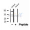 DF12161 at 1/100 staining Human brain cancer tissue by IHC-P. The sample was formaldehyde fixed and a heat mediated antigen retrieval step in citrate buffer was performed. The sample was then blocked and incubated with the antibody for 1.5 hours at 22¡ãC. An HRP conjugated goat anti-rabbit antibody was used as the secondary