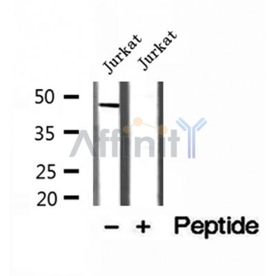 DF12161 at 1/100 staining Human brain cancer tissue by IHC-P. The sample was formaldehyde fixed and a heat mediated antigen retrieval step in citrate buffer was performed. The sample was then blocked and incubated with the antibody for 1.5 hours at 22¡ãC. An HRP conjugated goat anti-rabbit antibody was used as the secondary