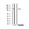Western blot analysis of extracts from mouse brain, using MCM10 antibody. Lane 1 was treated with the blocking peptide.