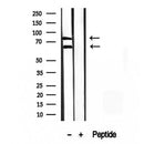 Western blot analysis of extracts from rat spleen, using Melanophilin antibody. Lane 1 was treated with the blocking peptide.