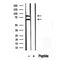 Western blot analysis of extracts from rat spleen, using Melanophilin antibody. Lane 1 was treated with the blocking peptide.