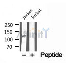 DF12164 at 1/100 staining Human lung tissue by IHC-P. The sample was formaldehyde fixed and a heat mediated antigen retrieval step in citrate buffer was performed. The sample was then blocked and incubated with the antibody for 1.5 hours at 22¡ãC. An HRP conjugated goat anti-rabbit antibody was used as the secondary