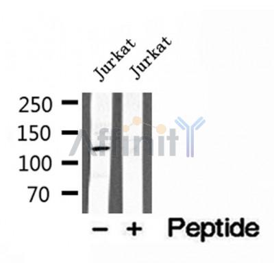 DF12164 at 1/100 staining Human lung tissue by IHC-P. The sample was formaldehyde fixed and a heat mediated antigen retrieval step in citrate buffer was performed. The sample was then blocked and incubated with the antibody for 1.5 hours at 22¡ãC. An HRP conjugated goat anti-rabbit antibody was used as the secondary