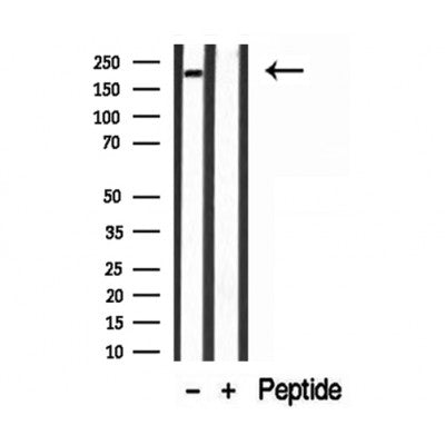 Western blot analysis of extracts from mouse lung, using MYH4-Specific antibody. Lane 1 was treated with the blocking peptide.