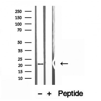 Western blot analysis of extracts from HepG2, using NUDT21 antibody. Lane 1 was treated with the blocking peptide.