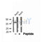 DF12168 at 1/100 staining Mouse kidney tissue by IHC-P. The sample was formaldehyde fixed and a heat mediated antigen retrieval step in citrate buffer was performed. The sample was then blocked and incubated with the antibody for 1.5 hours at 22¡ãC. An HRP conjugated goat anti-rabbit antibody was used as the secondary