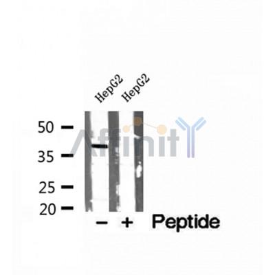 DF12168 at 1/100 staining Mouse kidney tissue by IHC-P. The sample was formaldehyde fixed and a heat mediated antigen retrieval step in citrate buffer was performed. The sample was then blocked and incubated with the antibody for 1.5 hours at 22¡ãC. An HRP conjugated goat anti-rabbit antibody was used as the secondary