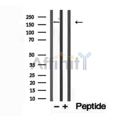 DF12169 staining HepG2 by IF/ICC. The sample were fixed with PFA and permeabilized in 0.1% Triton X-100,then blocked in 10% serum for 45 minutes at 25¡ãC. The primary antibody was diluted at 1/200 and incubated with the sample for 1 hour at 37¡ãC. An  Alexa Fluor 594 conjugated goat anti-rabbit IgG (H+L) Ab, diluted at 1/600, was used as the secondary antibod