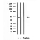 Western blot analysis of extracts from Mouse muscle, using RNH1 Antibody. The lane on the left was treated with blocking peptide.