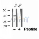DF12174 at 1/100 staining Mouse kidney tissue by IHC-P. The sample was formaldehyde fixed and a heat mediated antigen retrieval step in citrate buffer was performed. The sample was then blocked and incubated with the antibody for 1.5 hours at 22¡ãC. An HRP conjugated goat anti-rabbit antibody was used as the secondary