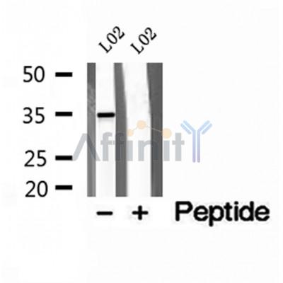 DF12174 at 1/100 staining Mouse kidney tissue by IHC-P. The sample was formaldehyde fixed and a heat mediated antigen retrieval step in citrate buffer was performed. The sample was then blocked and incubated with the antibody for 1.5 hours at 22¡ãC. An HRP conjugated goat anti-rabbit antibody was used as the secondary