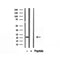 DF12175 staining Hela by IF/ICC. The samples were fixed with PFA and permeabilized in 0.1% Triton X-100,then blocked in 10% serum for 45 minutes at 25¡ãC. Samples were then incubated with primary Ab(DF12175 1:200) and mouse anti-beta tubulin Ab(T0023 1:200) for 1 hour at 37¡ãC. An  AlexaFluor594 conjugated goat anti-rabbit IgG(H+L) Ab(S0006 1:200 Red) and an AlexaFluor488 conjugated goat anti-mouse IgG(H+L) Ab(S0017 1:600 Green) were used as the secondary antibod