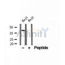 DF12176 staining HepG2 by IF/ICC. The sample were fixed with PFA and permeabilized in 0.1% Triton X-100,then blocked in 10% serum for 45 minutes at 25¡ãC. The primary antibody was diluted at 1/200 and incubated with the sample for 1 hour at 37¡ãC. An  Alexa Fluor 594 conjugated goat anti-rabbit IgG (H+L) Ab, diluted at 1/600, was used as the secondary antibod